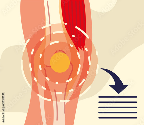 rheumatology knee banner