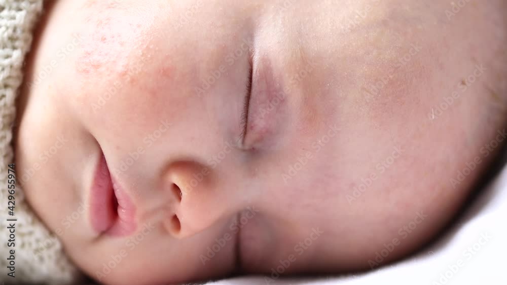 close-up face of sleeping baby infant sucking while dreaming close-up face of sleeping baby infant sucking while dreaming