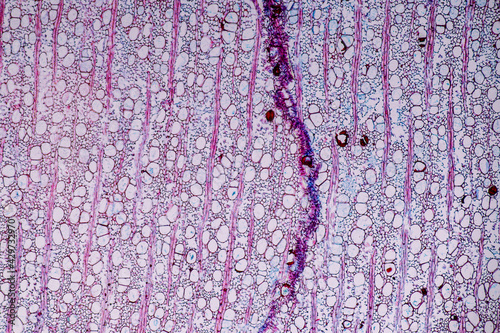 Characteristics of fungi living in wood as a group, are polyphyletic under the microscope for education.
 photo