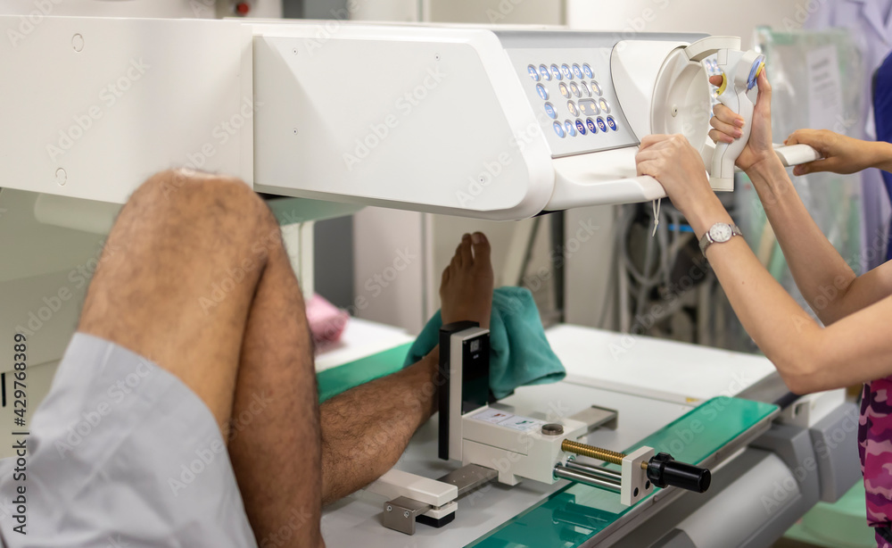 Selective focus with blurred.Doctor using stress test in ankle instability patient with chronic ankle sprain.The force was apply before radiographic study. Selective focus with blurred.Doctor using stress test in ankle instability patient with chronic ankle sprain.The force was apply before radiographic study.