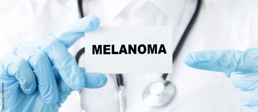 Card with text MELANOMA in the hands of a doctor. Medical concept. Card with text MELANOMA in the hands of a doctor. Medical concept.