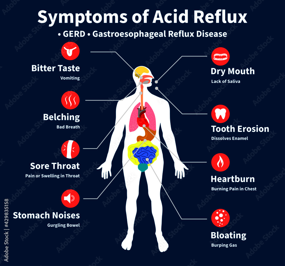 Symptoms of Acid Reflux, GERD, gastroesophageal reflux disease, Heartburn,  chronic Acidity, Gastric disease, stomach problem. Feeling pain bloating  abdomen reflux high acid illustration vector flat Stock Vector | Adobe Stock