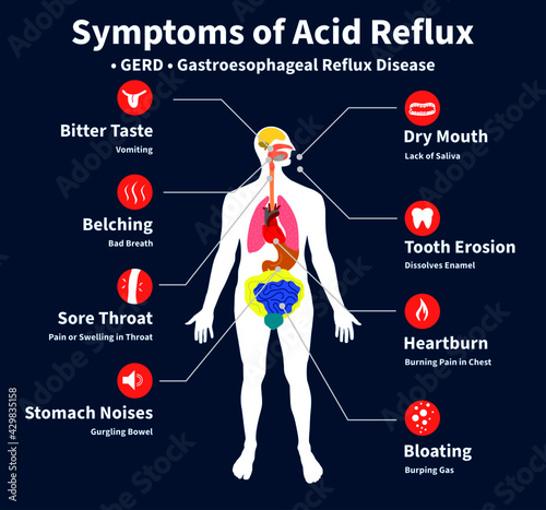 Symptoms of Acid Reflux, GERD, gastroesophageal reflux disease, Heartburn, chronic Acidity, Gastric disease, stomach problem. Feeling pain bloating abdomen reflux high acid illustration vector flat