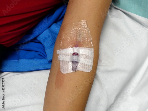 Modern peripheral venous catheter for intravenous infusion in the female arm in the hospital photo