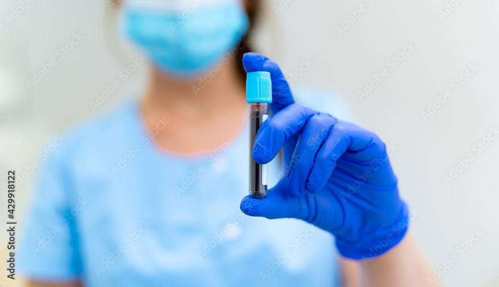Test tube with a blood test in a hand. Nurse holding test tube with Positive Coronavirus test blood sample. 2019-nCoV pandemic. Selective focus. Test tube with a blood test in a hand. Nurse holding test tube with Positive Coronavirus test blood sample. 2019-nCoV pandemic. Selective focus.