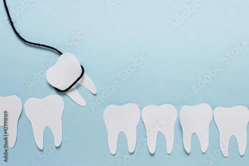 Simple dental tooth extraction concept made of paper and black rope on blue background photo