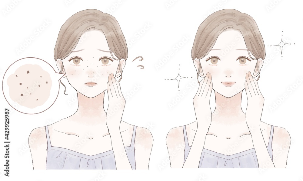 女性 毛穴 黒ずみ ビフォーアフター 女性 毛穴 黒ずみ ビフォーアフター