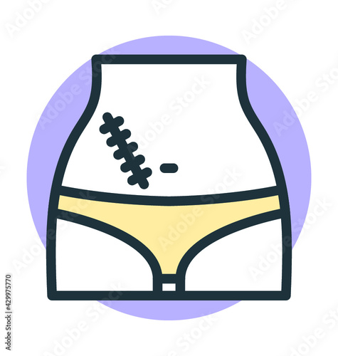 Appendix Surgery