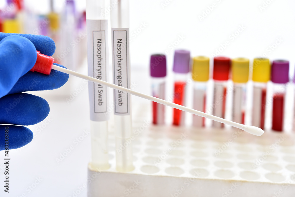 Test tube with nasopharyngeal swab from patient for COVID-19 testing by RT-PCR method Test tube with nasopharyngeal swab from patient for COVID-19 testing by RT-PCR method