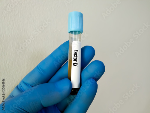 Принти на полотні Biochemist or Lab Technologist holds Blood samples for factor XI or plasma thromboplastin antecedent diagnosis of coagulation disorder test in the laboratory background