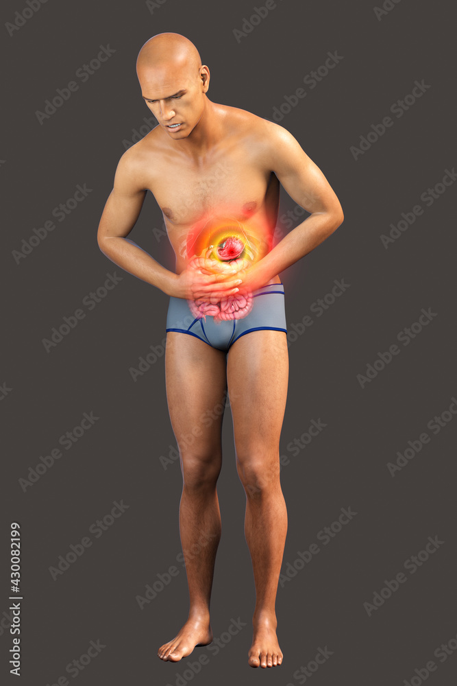 Abdominal pain, conceptual 3D illustration. A patient suffering from stomach pain