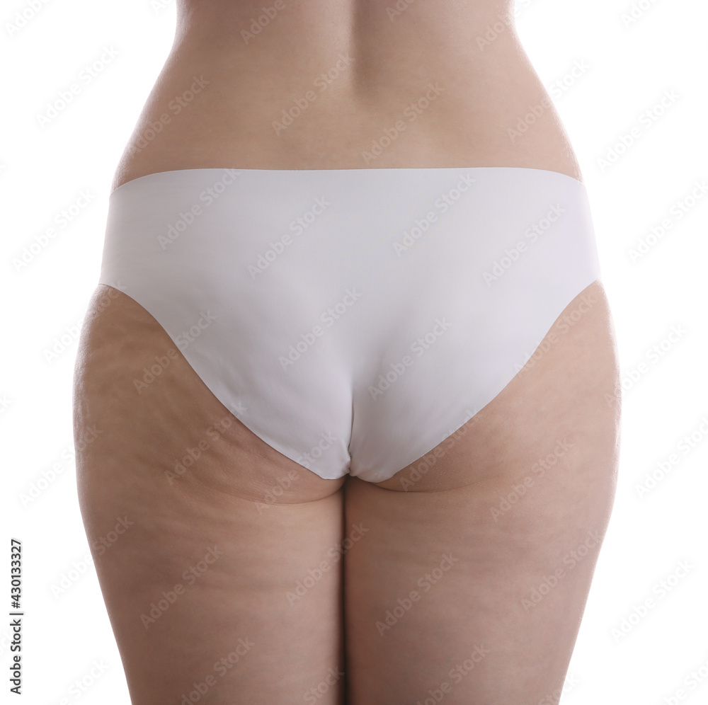 Woman with cellulite on white background, closeup - obrazy, fototapety, plakaty 