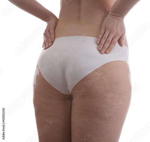 Woman with cellulite on white background, closeup