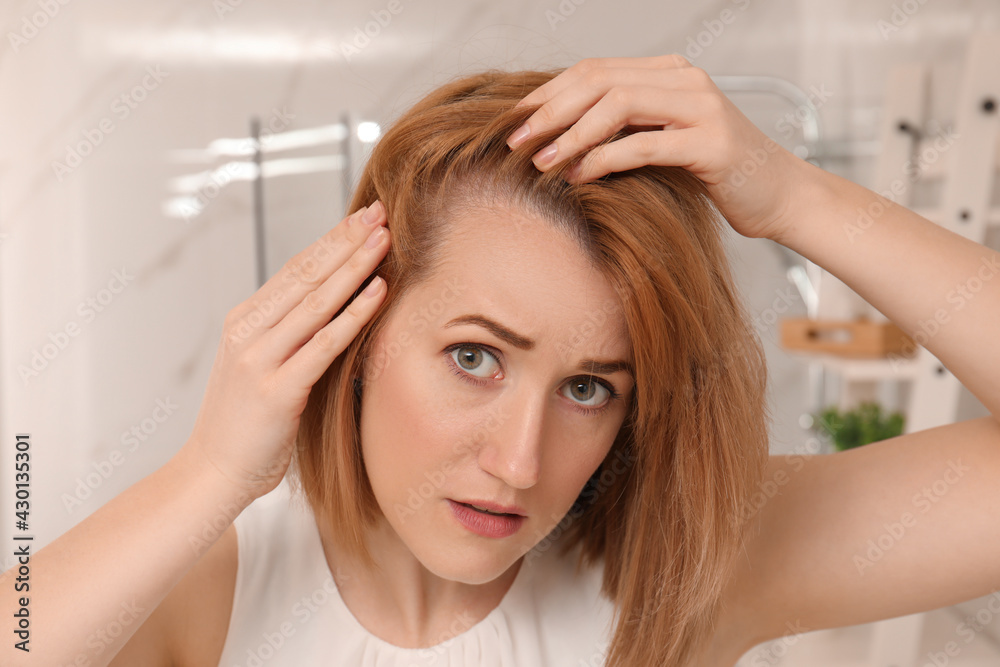 Fototapeta premium Sad woman suffering from baldness at home