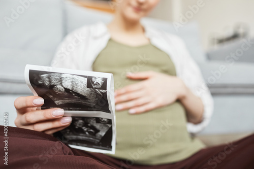 Close-up of pregnant woman holding ultrasound of her baby in her hands