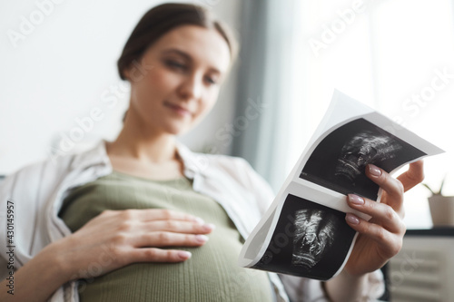 Pregnant woman holding x-ray image of her baby during her rest on the sofa at home photo