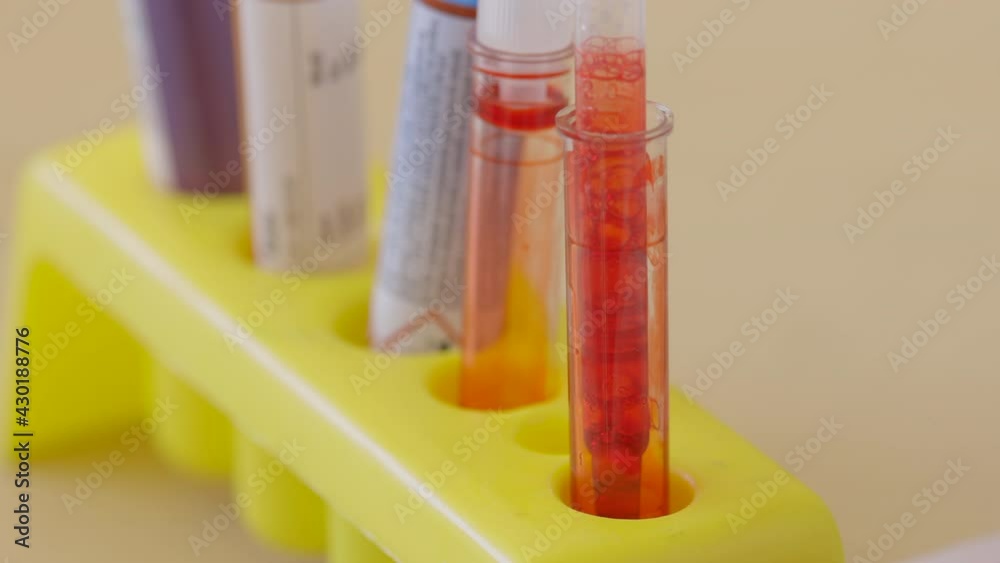 Red specimen in a sample tube. Clinical research concept in a laboratory Red specimen in a sample tube. Clinical research concept in a laboratory