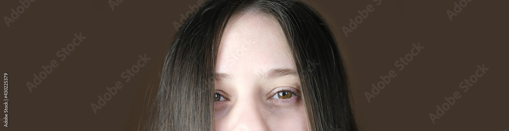 Naklejka premium young woman, part of the face, funny eyes close up, looking directly, the concept of diagnosis, treatment of ophthalmic diseases, eyelids, emotional, psychological state, banner