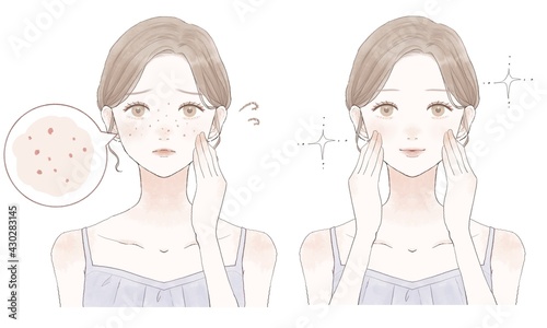 スキンケア　女性　皮脂毛穴　ビフォーアフター