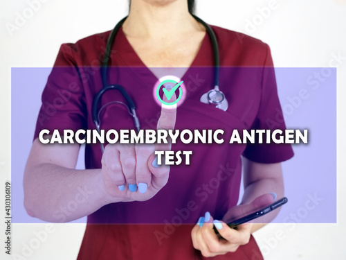 CARCINOEMBRYONIC ANTIGEN TEST CEA phrase on the screen. internist use cell technologies at office. photo