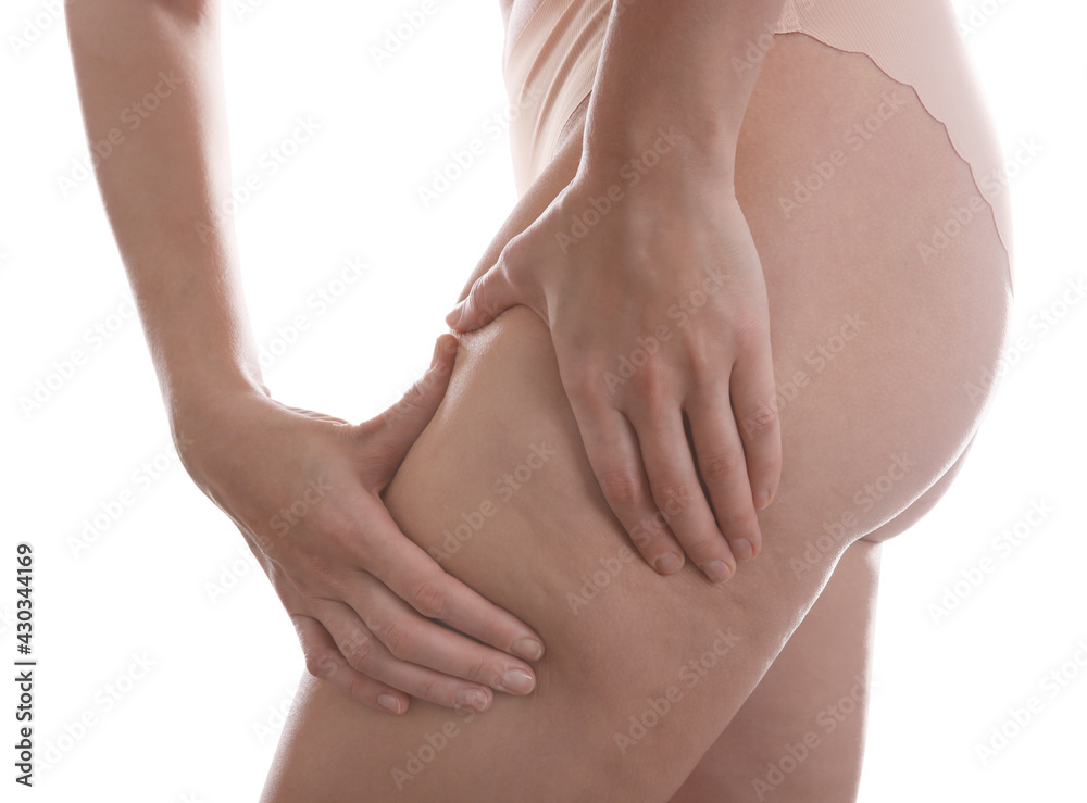Woman with cellulite on white background, closeup Woman with cellulite on white background, closeup