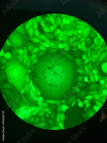 Polyploid human cell and expression of plasmid DNA encoding green fluorescent protein (GFP) photo