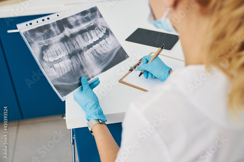 Fotografija Dental expert studying radiograph and writing on paper