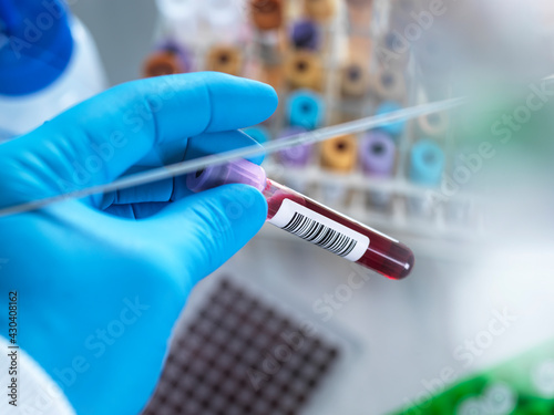 UK, Buckinghamshire, High Wycombe, Scientist holding hematology test vial