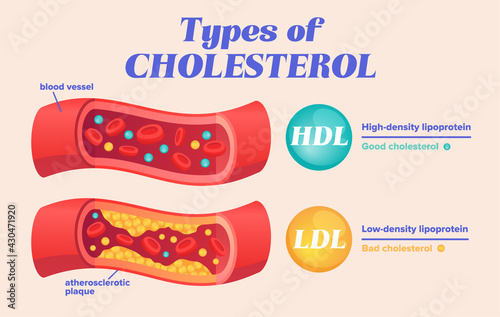 Types of cholesterol comparison with HDL and LDL