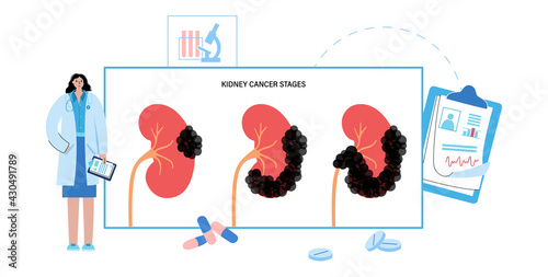 Kidney disease concept