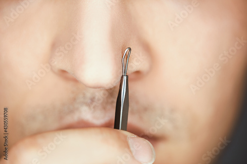 фотографія use pimple remover on male skin to care and clean pores and get blackheads out o