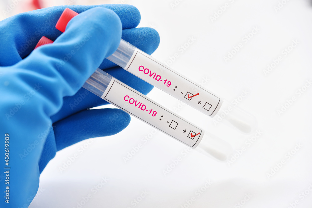 Naklejka premium Two nasopharyngeal swab sample positive and negative with COVID-19 virus 