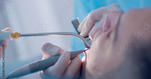 Close-up a male patient is having teeth cleaning by the dentist who is using dental tools. 
