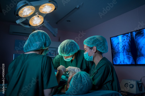 Canvas Print Medical team of surgeons in hospital working with electrocautery equipment for cardiovascular emergency surgery center
