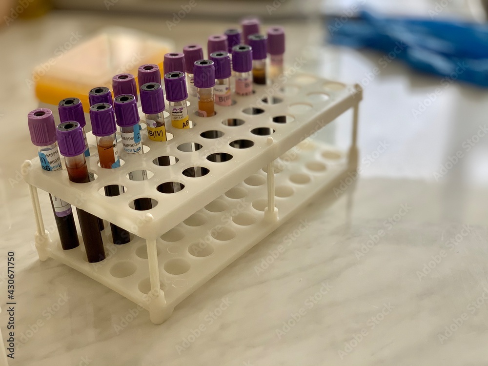 Test tubes with blood close-up in a laboratory in a plastic box holder. Laboratory research. Test tubes with blood close-up in a laboratory in a plastic box holder. Laboratory research.