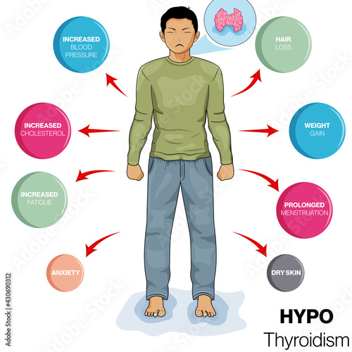 Illustration of Symptoms of Hypothyroidism disease in humans.