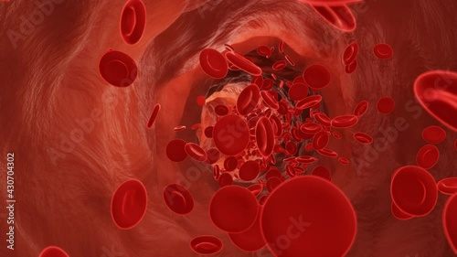 Red blood cells flowing in an artery. 3d video