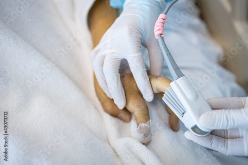 Hand of an asian patient in a severe coma with an attached pulse oximeter on fingertip,nurse measuring heart rate,checking oxygen saturation level,care,treatment of intensive care in ICU at hospital photo