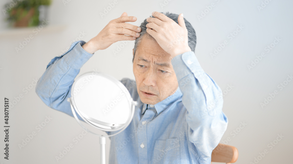 抜け毛を気にするシニア男性 抜け毛を気にするシニア男性