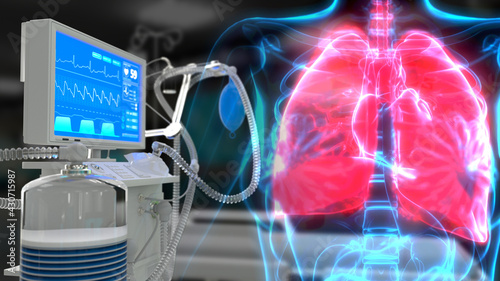 cg medical 3d illustration, human lungs and ICU lungs ventilator