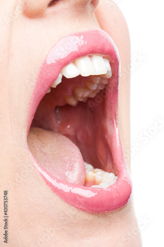 Open woman's mouth, showing tooth