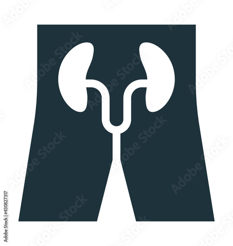 Kidneys 