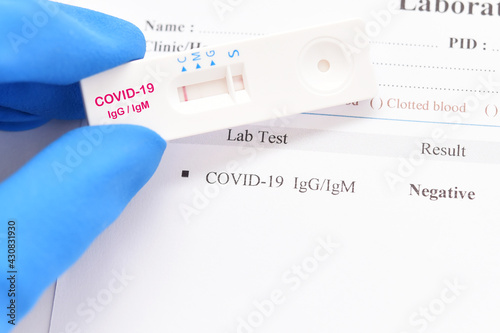 COVID-19 negative test result by using rapid card test for COVID-19 IgM/IgG antibody  photo