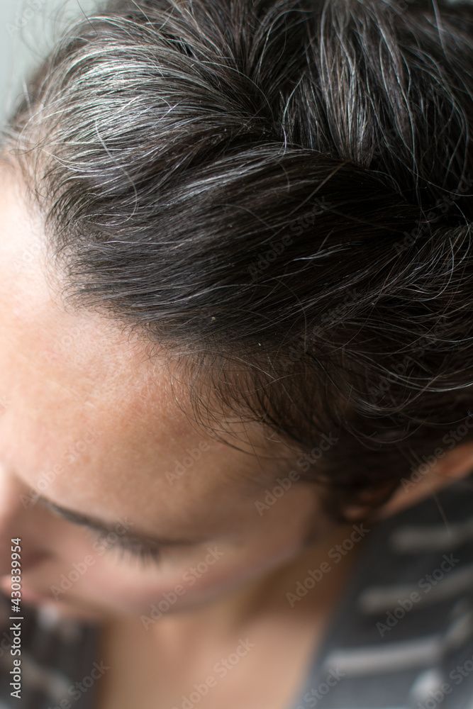 Fototapeta premium Top of woman's head: gray hair growing in