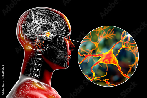 Amygdala in the brain, and closeup view of amygdala neurons, 3D illustration photo