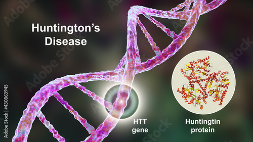 Huntington's disease, a neurodegenerative disease due to mutation in the huntingtin gene, HTT, conceptual 3D illustration photo