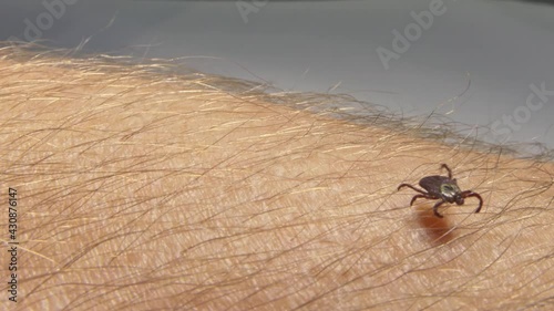 Tick crawling on the skin. High risk of infection with a tick-borne disease such as Lyme disease.