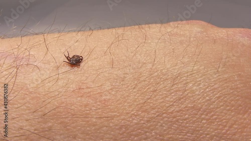 Tick crawling on the skin. High risk of infection with a tick-borne disease such as Lyme disease. photo