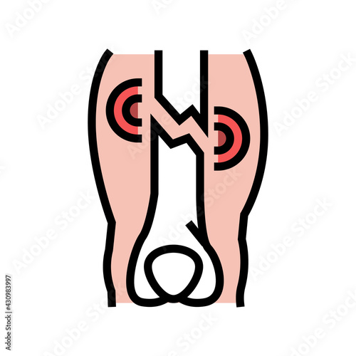 closed limb fracture disease color icon vector. closed limb fracture disease sign. isolated symbol illustration