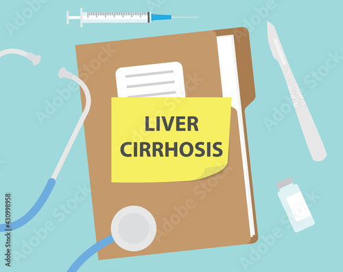 liver cirrhosis written on patient files - vector illustration- vector illustration